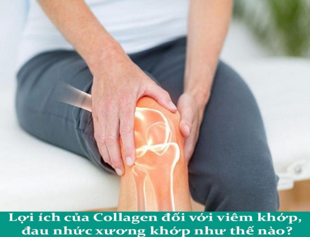 Collagen Nhật Bản là gì?