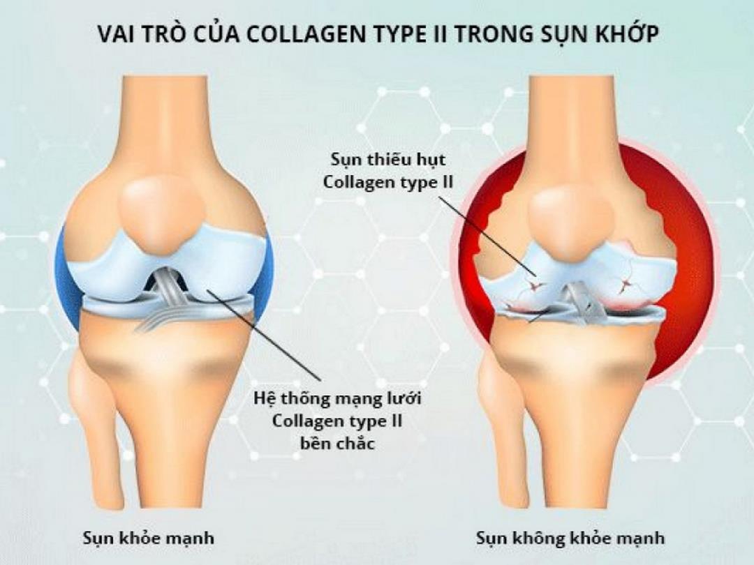 Vì sao nên uống collagen Nhật Bản cho xương khớp?